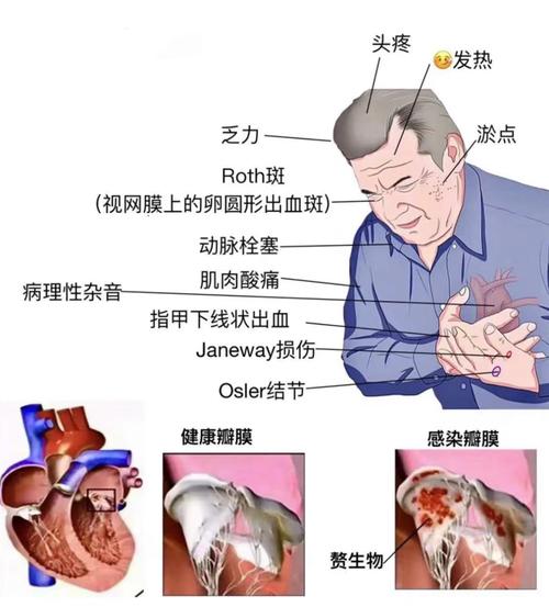 心脏有病,指甲先知丨每日话题